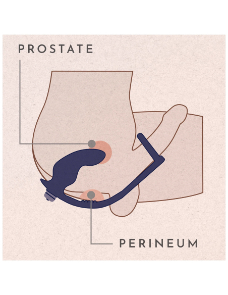 Plug prostatique avec anneaux pénien et testiculaires et vibromasseur rechargeable